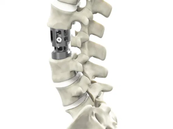 Spine Implants